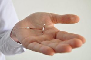 Today’s IUDs